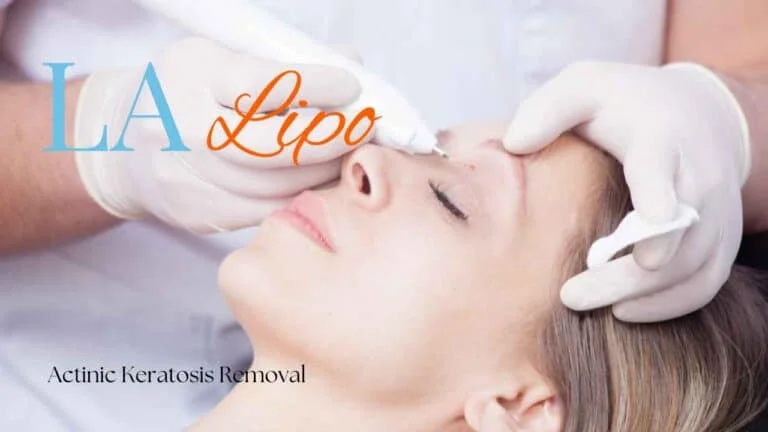 Woman receiving Actinic Keratosis Removal Treatment Hanwell