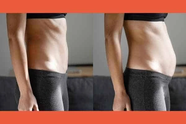 LA-EMS Body Sculpting results Hanwell