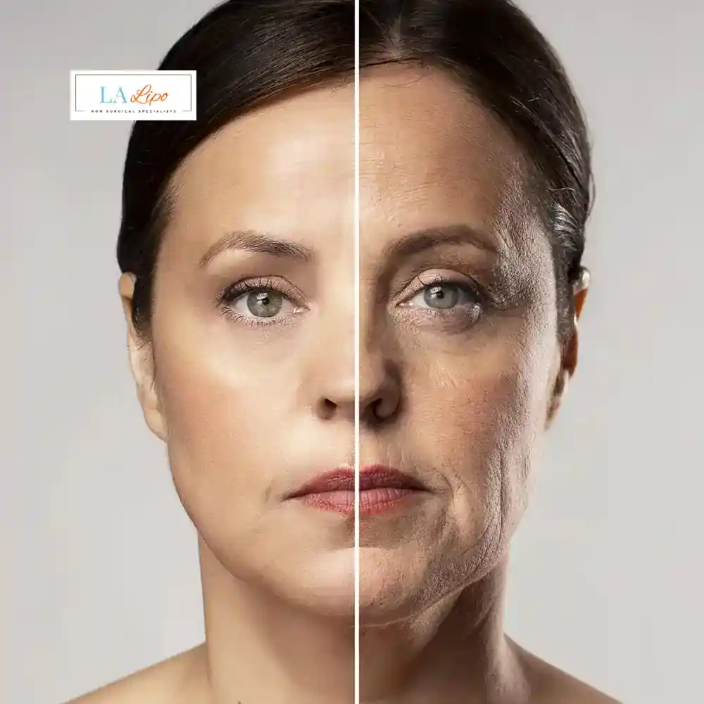 How Can You Tell If Non-Surgical Skin Tightening Is Right for You Hanwell?