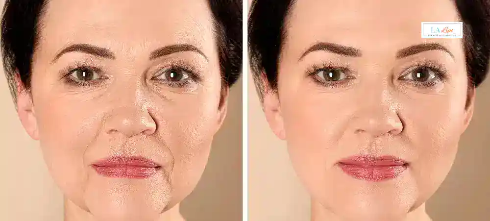 Why Aren’t My Skincare Products Making My Sagging Skin Look Firmer Hanwell?