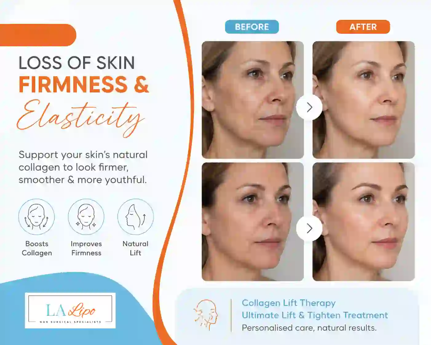 Sign #7: Loss of Skin Firmness and Elasticity Hanwell